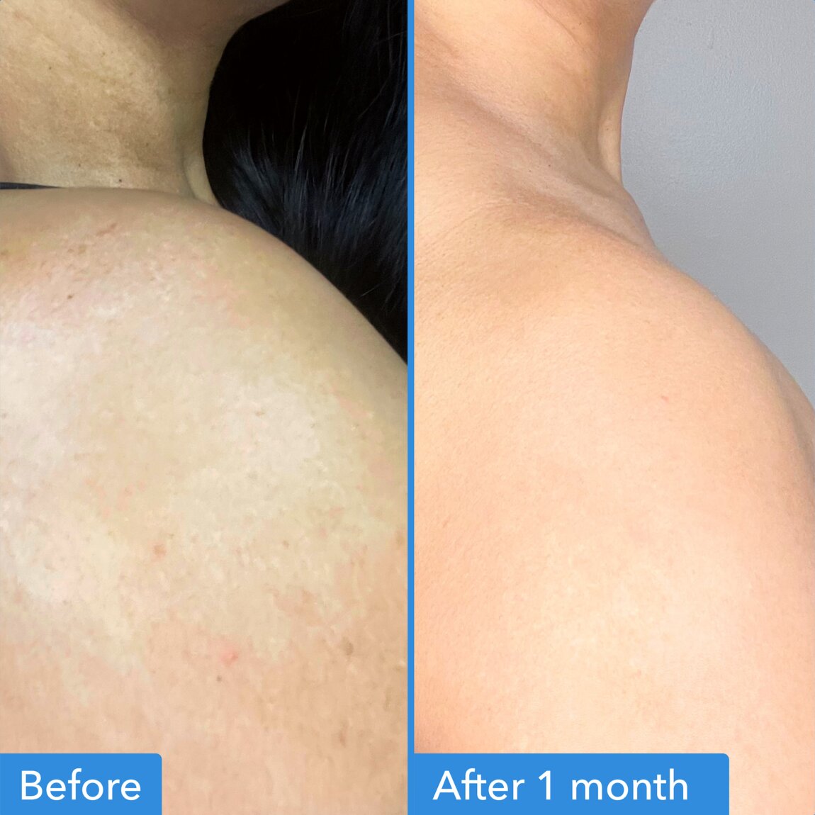 discoloration-correcting-body-treatment-d9 zb_p.jpg